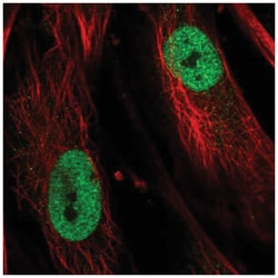 TBX5 Antibody, Novus Biologicals 25 &mu;L; Unconjugated:Antibodies, Polyclonal