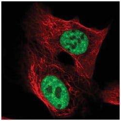 TCERG1 Antibody, Novus Biologicals 100&mu;L; Unlabeled:Antibodies, Polyclonal