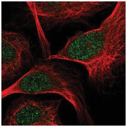 TCF7/TCF1 Antibody, Novus Biologicals 100&mu;L; Unlabeled:Antibodies, Polyclonal