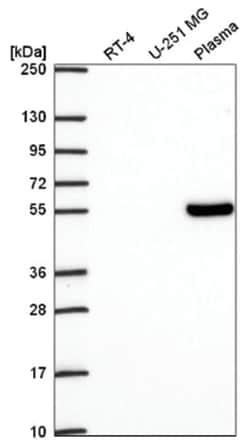 TCF7/TCF1 Antibody, Novus Biologicals 100&mu;L; Unlabeled:Antibodies, Polyclonal