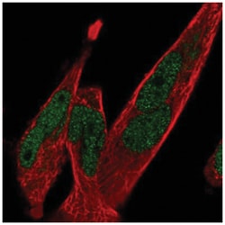 TCF7L1/TCF3 Antibody, Novus Biologicals 100&mu;L; Unlabeled:Antibodies,