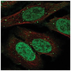 TDP1 Antibody, Novus Biologicals:Antibodies:Primary Antibodies