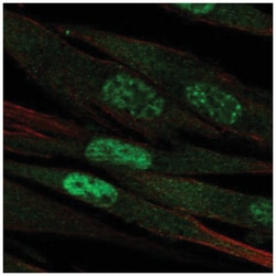 TERT Antibody, Novus Biologicals:Antibodies:Primary Antibodies