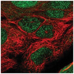 TET1 Antibody, Novus Biologicals 100&mu;L; Unlabeled:Antibodies, Polyclonal