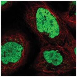 TEX2 Antibody, Novus Biologicals 100&mu;L; Unlabeled:Antibodies, Polyclonal