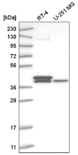 TFB2M Antibody, Novus Biologicals 25 &mu;L:Antibodies, Polyclonal