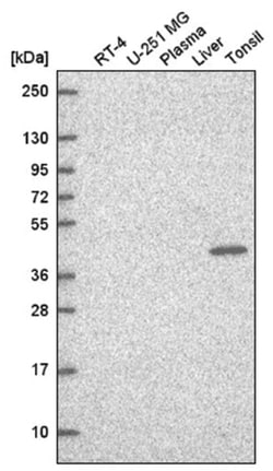 TFCP2 Antibody, Novus Biologicals 100&mu;L; Unlabeled:Antibodies, Polyclonal