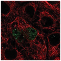 TFEC Antibody, Novus Biologicals 25 &mu;L, Unlabeled:Antibodies, Polyclonal
