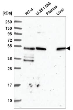 TFG Antibody, Novus Biologicals:Antibodies:Primary Antibodies