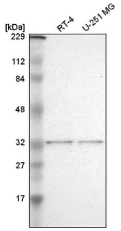 TFIIE beta Antibody, Novus Biologicals:Antibodies:Primary Antibodies