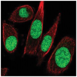 TFIIE-alpha Antibody, Novus Biologicals 25 &mu;L, Unlabeled:Antibodies,