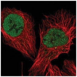 TFIISH Antibody, Novus Biologicals 25 &mu;L, Unlabeled:Antibodies, Polyclonal