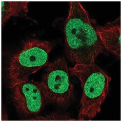 TFPT Antibody, Novus Biologicals 25 &mu;L:Antibodies, Polyclonal