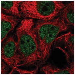 TGF beta induced factor 2 Antibody, Novus Biologicals 25 &mu;L, Unlabeled:Antibodies,