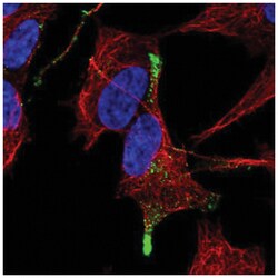 TGF-beta 3 Antibody, Novus Biologicals 25 &mu;L, Unlabeled:Antibodies,