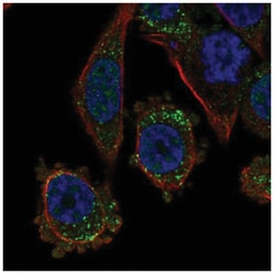 TGFBR3L Antibody, Novus Biologicals 100 &mu;L | Buy Online | Novus Biologicals | Fisher Scientific