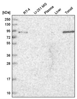 TGFBRAP1 Antibody, Novus Biologicals 25 &mu;L, Unlabeled:Antibodies, Polyclonal