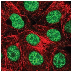 THAP4 Antibody, Novus Biologicals:Antibodies:Primary Antibodies