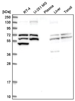 Thioredoxin Reductase 1/TRXR1 Antibody, Novus Biologicals 100&mu;L; Unlabeled:Antibodies,
