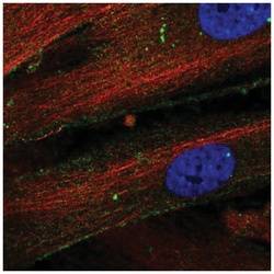 Thrombospondin-1 Antibody, Novus Biologicals:Antibodies:Primary Antibodies