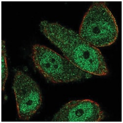 THSD7B Antibody, Novus Biologicals:Antibodies:Primary Antibodies