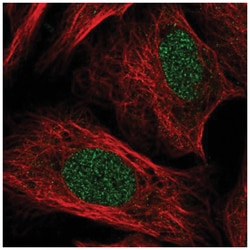 TOX Antibody, Novus Biologicals 25 &mu;L, Unlabeled:Antibodies, Polyclonal