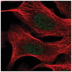 TIA1 Antibody, Novus Biologicals 25 &mu;L:Antibodies, Polyclonal
