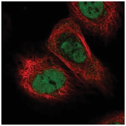 TICRR Antibody, Novus Biologicals:Antibodies:Primary Antibodies