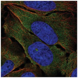 Tie-2 Antibody, Novus Biologicals 100&mu;L; Unlabeled:Antibodies, Polyclonal