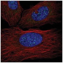 TIN2 Antibody, Novus Biologicals 25 &mu;L, Unlabeled:Antibodies, Polyclonal