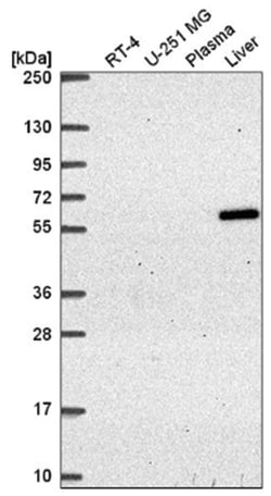 TIN2 Antibody, Novus Biologicals 100&mu;L; Unlabeled:Antibodies, Polyclonal