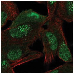 TIP120A Antibody, Novus Biologicals 100&mu;L; Unlabeled:Antibodies, Polyclonal