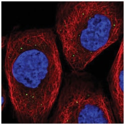 TIPRL Antibody, Novus Biologicals:Antibodies:Primary Antibodies