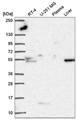 Tissue alpha-L-Fucosidase/FUCA1 Antibody, Novus Biologicals 100 &mu;L | Buy Online | Novus Biologicals | Fisher Scientific