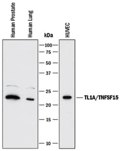 Human TL1A/TNFSF15 Antibody, R D Systems 25&mu;g; Unlabeled:Antibodies,