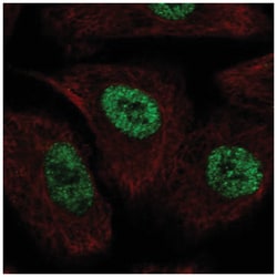 TLE1 Antibody, Novus Biologicals 25 &mu;L, Unlabeled:Anticuerpos