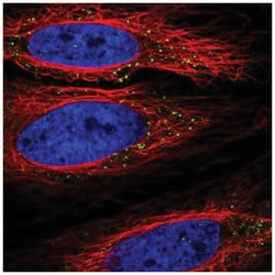 TLL1 Antibody, Novus Biologicals 100 &mu;L | Buy Online | Novus Biologicals | Fisher Scientific
