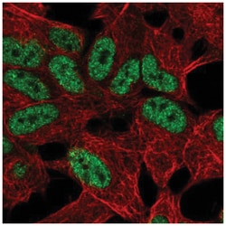 TLX2 Antibody, Novus Biologicals 25 &mu;L, Unlabeled:Antibodies, Polyclonal