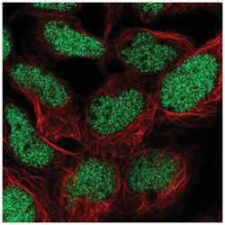 TM2D1 Antibody, Novus Biologicals 100&mu;L; Unlabeled:Antibodies, Polyclonal