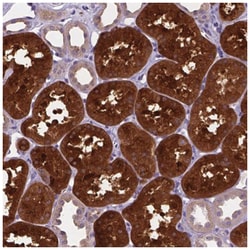 TM4SF18 Antibody, Novus Biologicals 25 &mu;L, Unlabeled:Antibodies, Polyclonal
