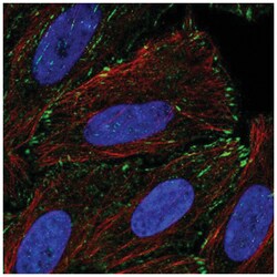 TM4SF20 Antibody, Novus Biologicals 25 &mu;L, Unlabeled:Antibodies, Polyclonal