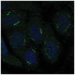 TMBIM4 Antibody, Novus Biologicals 100&mu;L; Unlabeled:Antibodies, Polyclonal