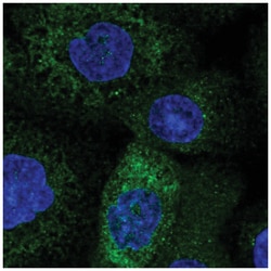 TMCO1 Antibody, Novus Biologicals 25 &mu;L:Antibodies, Polyclonal