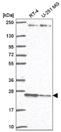 TMED3 Antibody, Novus Biologicals 100&mu;L; Unlabeled:Antibodies, Polyclonal