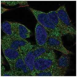 TMEM145 Antibody, Novus Biologicals 100&mu;L; Unlabeled:Antibodies, Polyclonal