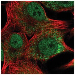 TMEM14A Antibody, Novus Biologicals 25 &mu;L, Unlabeled:Antibodies, Polyclonal