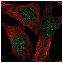 TMEM179B Antibody, Novus Biologicals 100&mu;L; Unlabeled:Antibodies, Polyclonal