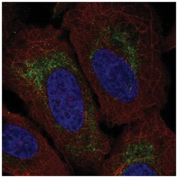 TMEM185A Antibody, Novus Biologicals 100&mu;L; Unlabeled:Antibodies, Polyclonal