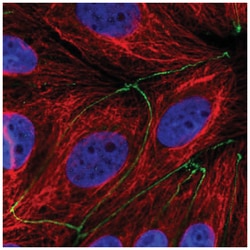TMEM186 Antibody, Novus Biologicals 100 &mu;L | Buy Online | Novus Biologicals | Fisher Scientific