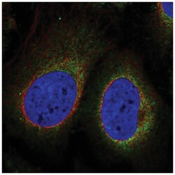 TMEM188 Antibody, Novus Biologicals 25 &mu;L; Unlabeled:Antibodies, Polyclonal